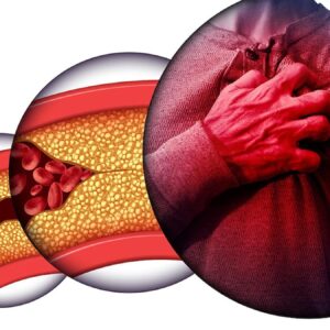 kolesterol dusman mi denge mi uyLsEeSJ