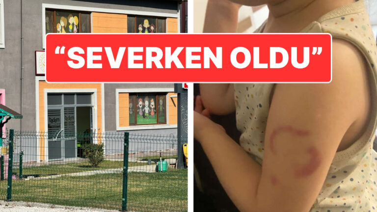 koldaki isirik izine ogretmenden ilginc savunma isirmadim operken oldu mqHm9IqU.jpg