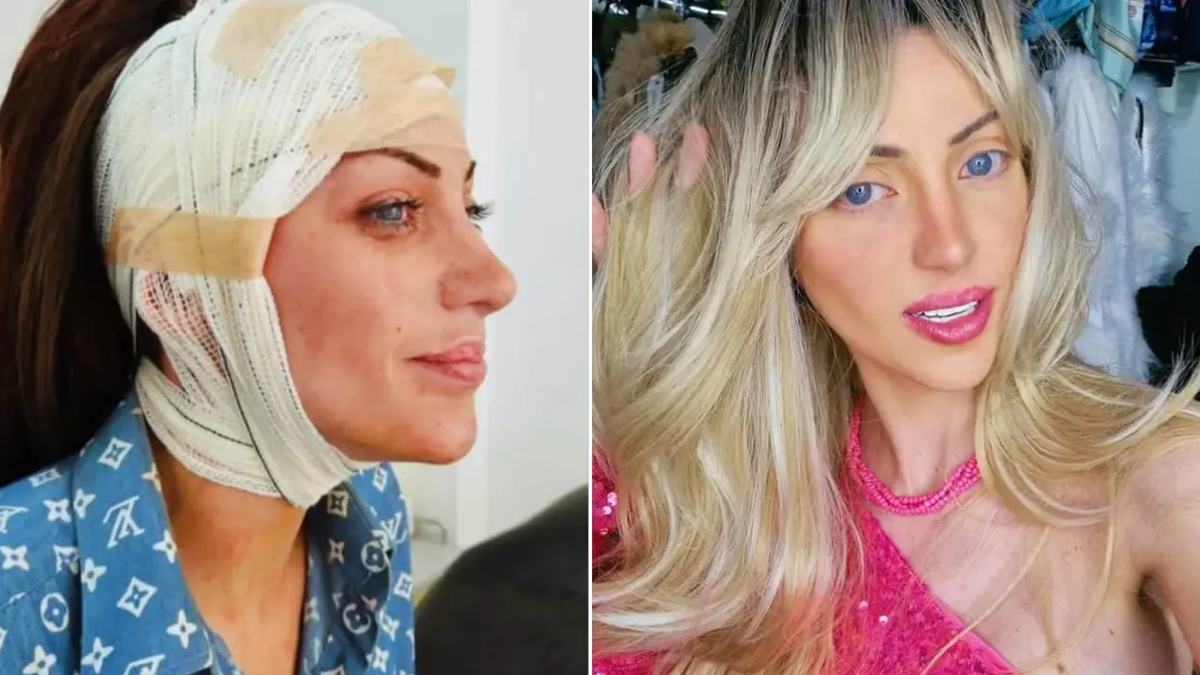 barbie bebege benzemek icin 27 kez ameliyat oldu brezilyali fenomen 31 yasinda hayatini kaybetti OkpxCFEN.jpg