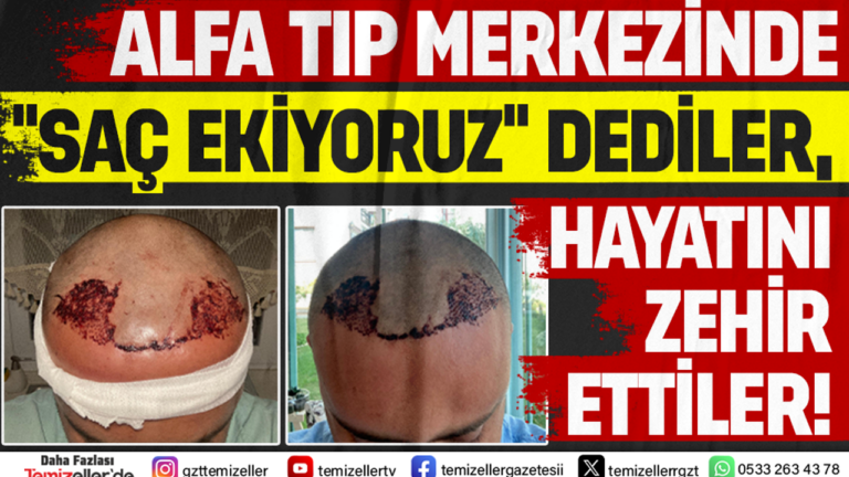 alfa-tip-merkezinde-sac-ekiyoruz-dediler-hayati-zehir-ettiler-GwLnKcJA.png